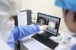 Doctors talk about the CT images of a patient's lungs in a fever clinic in Yinan county in east China's Shandong province Wednesday, Feb. 12, 2020. The disease caused by the new coronavirus has been officially named by the World Health Organisation as Covid-19 on Feb. 11, 2020. 