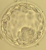 A blastocyst under the microscope.  That's an embryo that is about five days old. 
Two similar blastocysts were transferred into Mardi Palan.