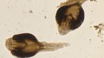 A microscopic view of two parasites with tails and horseshoe shaped bodies.