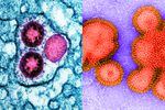 Health officials are predicting this winter could see an active flu season on top of potential COVID surges. In short, it's a good year to be a respiratory virus. Left: Image of SARS-CoV-2 omicron virus particles (pink) replicating within an infected cell (teal). Right: Image of an inactive H3N2 influenza virus.
