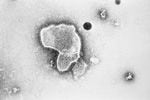 FILE - This 1981 photo provided by the Centers for Disease Control and Prevention (CDC) shows an electron micrograph of respiratory syncytial virus, also known as RSV.  New research announced by Pfizer on Tuesday, November 1, 2022, showed that vaccinating pregnant women helped protect their newborns from the common but terrifying respiratory virus that fills hospitals with wheezing babies every fall.