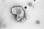 FILE - This 1981 photo provided by the Centers for Disease Control and Prevention (CDC) shows an electron micrograph of Respiratory Syncytial Virus, also known as RSV.