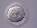 Light micrograph of a successfully fertilized oocyte after an in vitro fertilization (IVF) procedure.