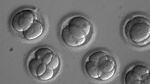 In this microscope photo provided by Oregon Health & Science University, human embryos grow in a laboratory for a few days after researchers used gene editing technology to successfully repair a heart disease-causing genetic mutation.