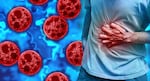 Cyclosporiasis is a parasitic illness caused by eating or drinking contaminated food or water.