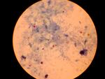 Cryptosporidium parvum