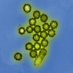 Electron micrograph showing H1N1 influenza virus particles.