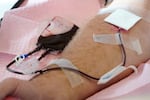 FILE - Tubes direct blood from a donor into a bag in Davenport, Iowa, on Friday, Nov. 11, 2022.