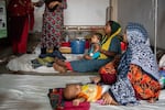 Rizvi Ahmed Raihan, a nine month old measles infected boy sits on his mothers lap while speaking with a pediatrician at Infectious Disease Hospital in Dhaka, Bangladesh, on 17 May, 2026.
