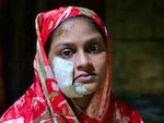 Raashida, 15, says she was injured in her family's home in Rakhine State, Myanmar, on August 7 in a drone attack by the Arakan Army. Her mother and one sibling also sustained injuries. According to Amnesty International, "Rohingya civilians are now caught in the middle of intensifying conflict in Rakhine State between the Arakan Army and the Myanmar military." Raashida's family has fled Myanmar for Bangladesh, where nearly 1 million Rohingya refugees live in camps, having left their homes due to anti-Muslim persecution and violence. 