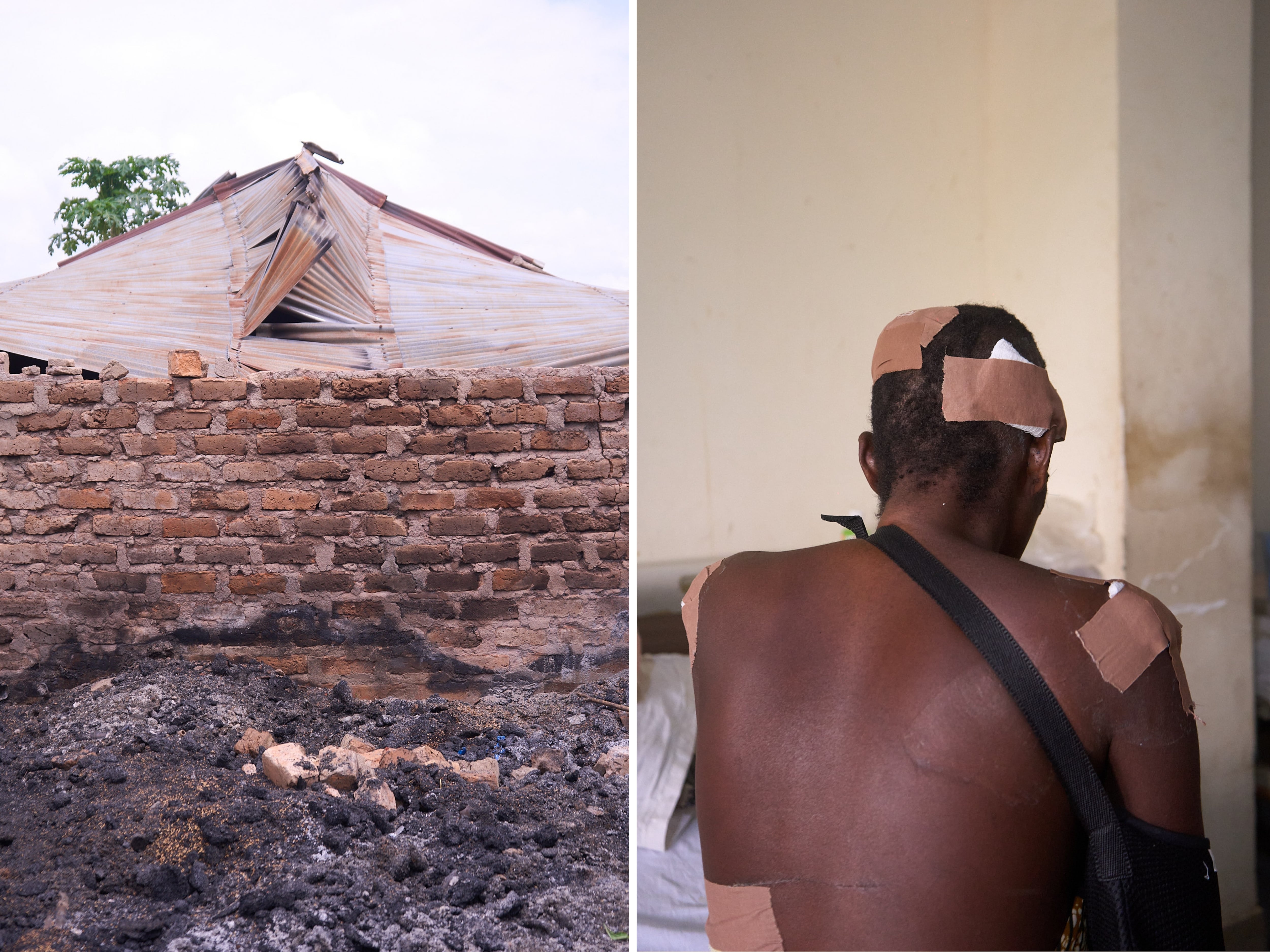 Left: Ash and debris is seen in a building in the village of Yelwata in Nigeria, left by the attack in mid-June. Right: A survivor of the attack sits on a hospital bed.