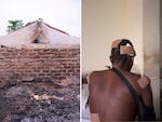 Left: Ash and debris is seen in a building in the village of Yelwata in Nigeria, left by the attack in mid-June. Right: A survivor of the attack sits on a hospital bed.