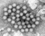 FILE - This electron microscope image provided by the Centers for Disease Control and Prevention shows a cluster of norovirus virions.