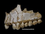 A dental calculus deposit is visible on the rear molar (right). The teeth belong to the sick boy in the Spanish cave. He was eating poplar, a source of aspirin, and vegetation with mold, including the fungus Penicillium, which is the source of the antibiotic penicillin.