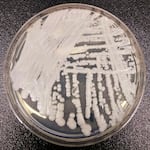 Astrain of Candida auris cultured in a petri dish at a CDC laboratory