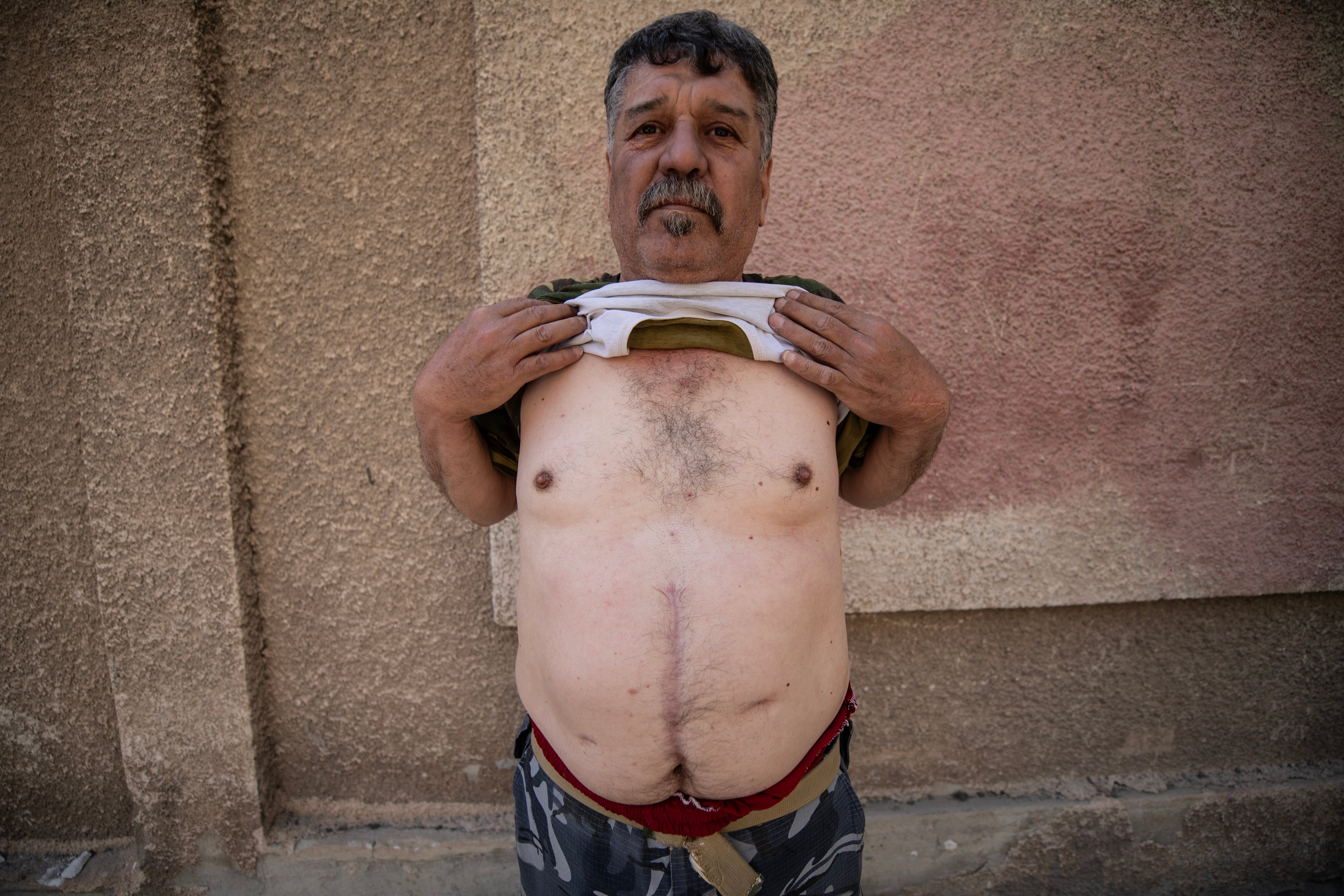 Hussein Elyassine, a former Assad regime firefighter, lifts his shirt to show a scar running down his stomach — the result of an injury he sustained in an attack he believes was committed by the Assad regime.