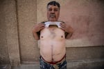Hussein Elyassine, former regime firefighter, shows a scar running down his stomach caused from an attack by the old regime.