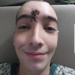 Donavan La Bella, 26, was shot in the head by a U.S. Marshal and suffered a frontal lobe skull fracture during protests against racism and police violence in Portland. Two weeks later, before being released from the hospital, his mom said he still has cognitive problems and struggles with impulse control.