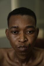 Munir Jelabi, 24, at a military hospital in Khartoum, where he is being treated for conditions caused by severe malnutrition. He was arrested by RSF and held in a detention center for over a year. "They only gave us a small glass of lentils and a small glass of water each day," he says. "Some days we received nothing."