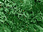 An image from an electron microscope of the monkeypox virus (orange) on infected cells (green).