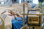 The most critical patients are placed on extracorporeal membrane oxygenation, or ECMO, which removes blood from the patient, infuses it with oxygen, right, and the oxygen rich blood is recirculated to the patient’s body. Every bed on this intensive care unit at Oregon Health and Science University is critically ill with COVID-19 in Portland, Ore., Aug. 19, 2021.