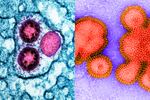 Health officials are predicting this winter could see an active flu season on top of potential COVID surges. In short, it's a good year to be a respiratory virus. Left: Image of SARS-CoV-2 omicron virus particles (pink) replicating within an infected cell (teal). Right: Image of an inactive H3N2 influenza virus.