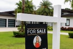 A For Sale sign sits in front of a home.