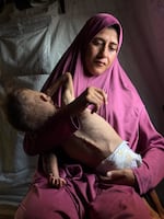 Mohammad is a year and a half old and nearly all bone. His eyes protrude, as does his swollen stomach. His spine is so sharp and so defined, it seems it might poke through his thin skin.