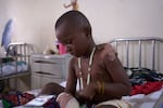 Four-year-old Onyuso David, who was hurt in the mid-June attacks, watches a comedy show on his grandmother's phone.