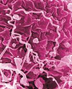 Treponema pallidum, the bacteria that causes syphilis.