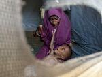 In the tent where they are living after being displaced by the war, baby Mohammad reaches up to his mother in the Gaza Strip. His five-year-old sister is faring better, but Mohammad's small body has been unable to withstand the hunger.