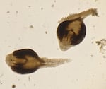 A microscopic view of two parasites with tails and horseshoe shaped bodies.