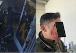 A photo of an ICE officer who was allegedly struck with a rock at the Portland ICE building on June 14, 2025. Robert Jacob Hoopes is accused of throwing the rock that hit him, and has been charged with aggravated assault of a federal officer.