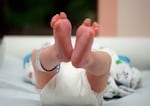 A newborn baby's feet are shown in a close-up photo. A hospital anklet is visible.