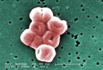 A highly magnified cluster of Acinetobacter bacteria. They're widely distributed in nature and can cause hospital acquired infections.