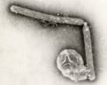 This undated electron microscopic image provided by the Centers for Disease Control and Prevention shows two Influenza A (H5N1) virions, a type of bird flu virus. (Cynthia Goldsmith, Jackie Katz/CDC via AP)