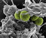 MRSA is a leading cause of hospital-associated infections in the United States and United Kingdom.