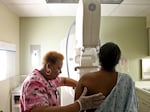 The most recent recommendation of the U.S. Preventive Services Task Force is that all women 40 to 74 get mammograms every other year. A previous recommendation said screening should start at 50. One doctor suggests that people "test smarter, not test more."