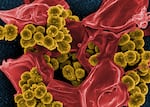 This image from the National Institutes of Health shows a scanning electron microscope image of methicillin-resistant Staphylococcus aureus bacteria (yellow) and a dead human white blood cell (colored red.) Researchers at the University of Oregon have found a common skin yeast that inhibits the grown of staph bacteria and could unlock new treatments for staph infections.