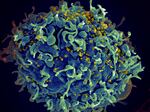 This electron microscope image made available by the U.S. National Institutes of Health shows a human T cell, in blue, under attack by HIV, in yellow, the virus that causes AIDS.