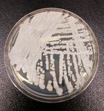 This undated photo made available by the Centers for Disease Control and Prevention shows a strain of Candida auris cultured in a petri dish at a CDC laboratory. The U.S. toll of drug-resistant "superbug" infections worsened during the first year of the COVID-19 pandemic, health officials said Tuesday, July 12, 2022.