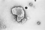 FILE - This 1981 photo provided by the Centers for Disease Control and Prevention (CDC) shows an electron micrograph of Respiratory Syncytial Virus, also known as RSV.