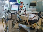Aug. 19, 2021: The most critical patients in the intensive care unit at Oregon Health and Science University are connected to an Extracorporeal Membrane Oxygenation, or ECMO, which removes blood from the patient, routed through an  oxygenator unit (right) and then the oxygen rich blood is recirculated to the patient’s body. 