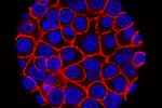This undated microscope image from USC via the NIH shows pancreatic cancer cells, nuclei in blue, growing as a sphere encased in membranes, red.