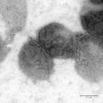 Neisseria gonorrhoeae cells, the bacteria that causes gonorrhea, as seen via transmission electron microscopy.
