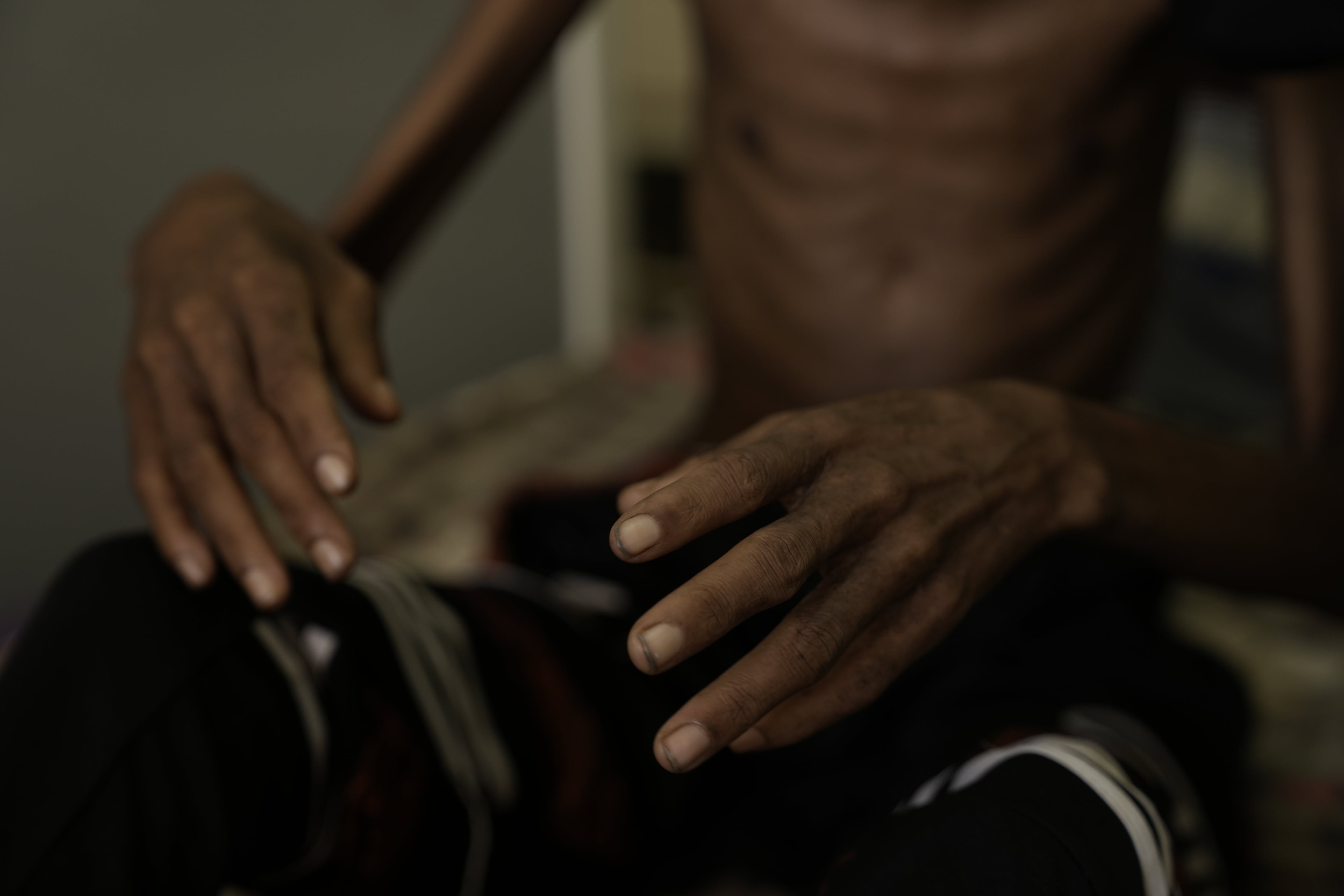 The thin hands and body of 24-year-old Munir Jelabi, who is being treated at a military hospital in Khartoum for conditions caused by severe malnutrition.