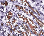 This microscopic image shows the H5N1 bird flu virus.