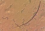 A bunch of squiggles as seen under a microscope, with a magnified eyelash in the center.