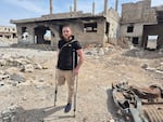 "The regime has fallen, and I need to transition to civilian life," says former opposition fighter Omar Halaby, 29, who lost his right leg during a 2017 attack by Syrian forces loyal to then-President Bashar al-Assad. "Part of that process is seeing my late friends one last time, to give them a dignified reburial."