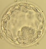 A blastocyst under the microscope.  That's an embryo that is about five days old. 
Two similar blastocysts were transferred into Mardi Palan.